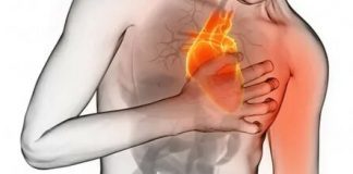 ANGINA SYMPTOMS, CAUSES AND ITS TREATMENT
